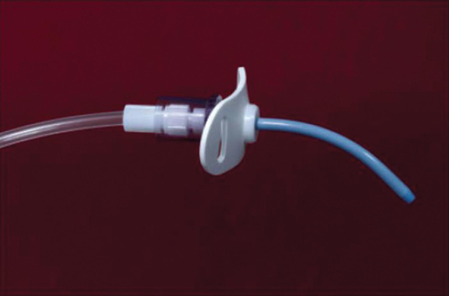 Fig. 28.3, Arndt Emergency Cricothyrotomy Catheter. (Courtesy Cook Medical, Bloomington, IN.)