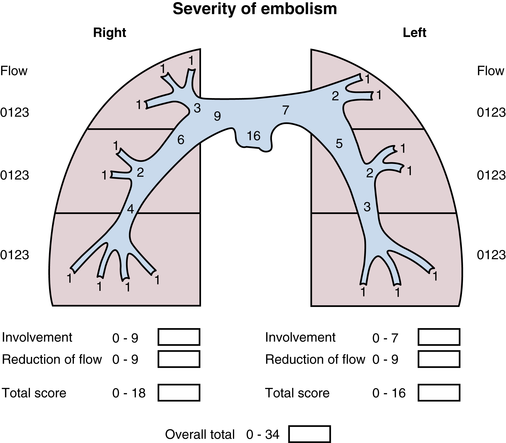 Percutaneous Interventions for Acute Pulmonary Embolism - Clinical Tree