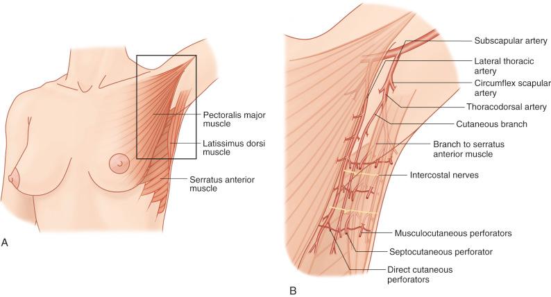 Figure 56.2, The network of perforators in the left lateral thoracic region.