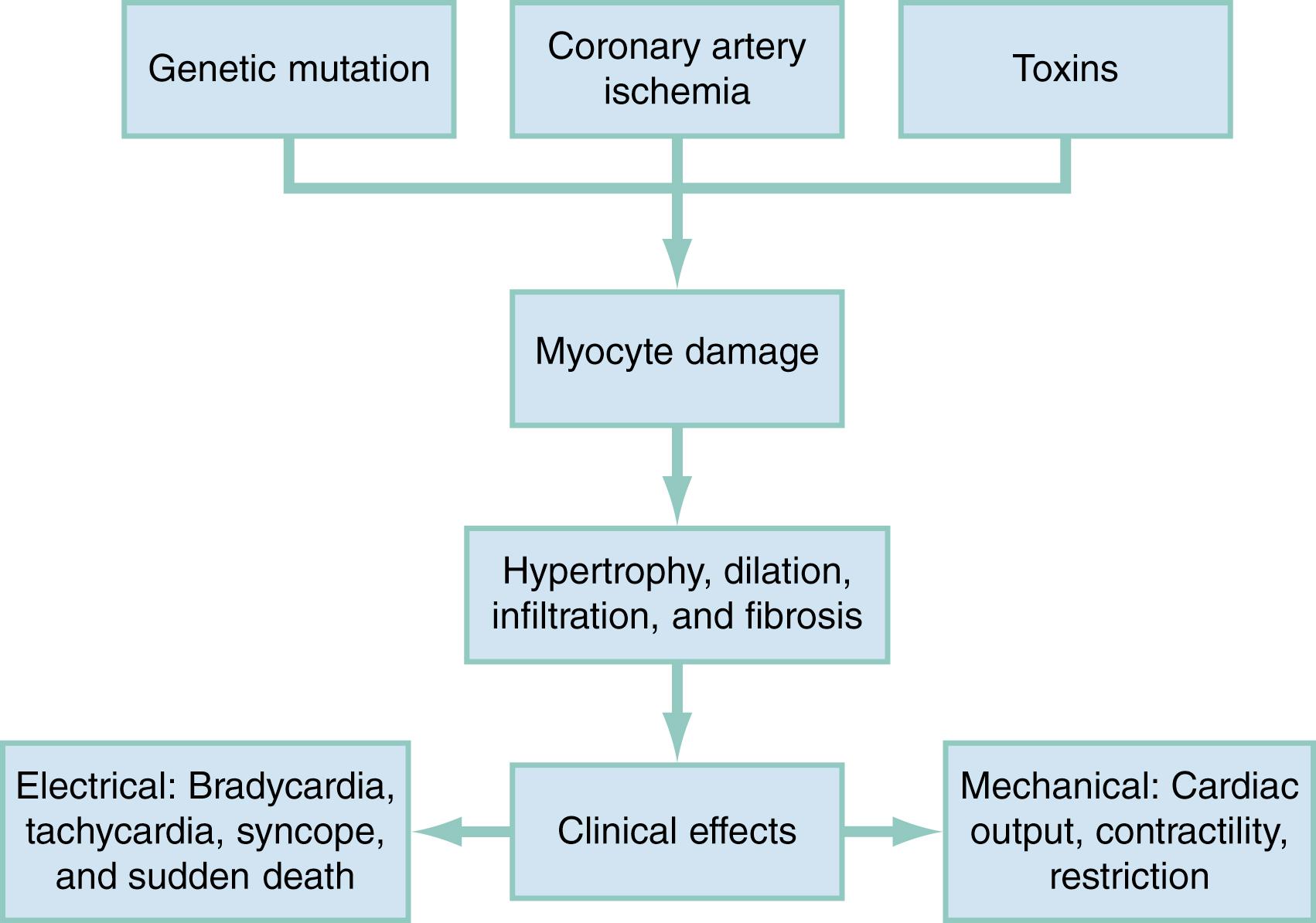 Fig. 68.1, Cardiomyopathy pathogenesis.