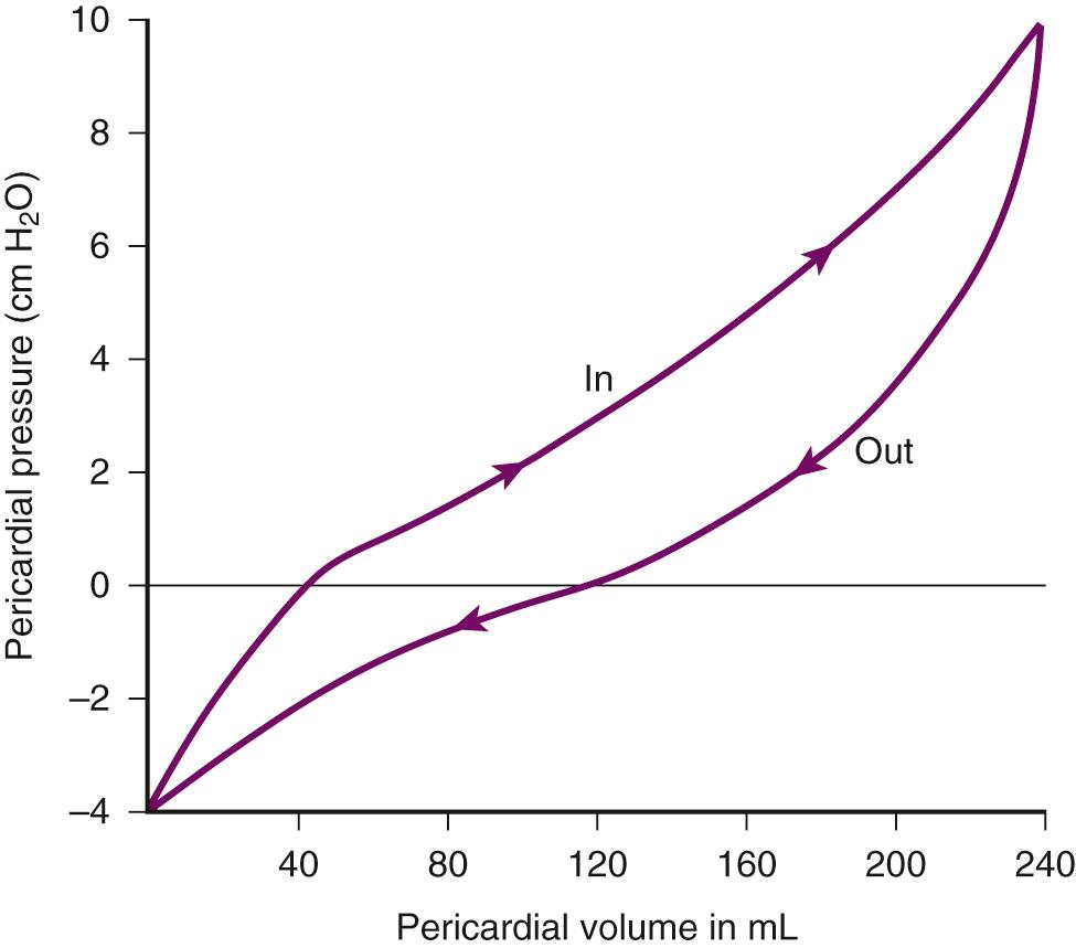 Figure 16.3, Relationship of intrapericardial pressure to volume of pericardial fluid. Pressure drops rapidly when a small amount of fluid is removed, hence the initial significant benefit of pericardiocentesis.