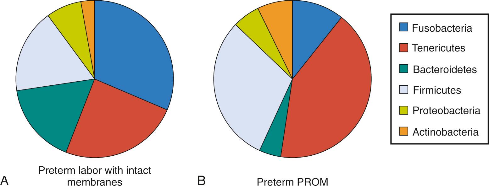 Fig. 25.4, Phylum-level distribution of bacterial taxa identified in amniotic fluid. Data obtained from studies using broad-range polymerase chain reaction (PCR) methods to assay amniotic fluid in the setting of either preterm labor with intact membranes, A , or of preterm premature rupture of the membranes (PPROM), B .