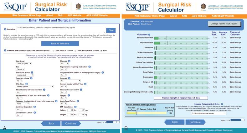 Fig. 1.2, National Surgical Quality Improvement Program (NSQIP) risk calculator. (A) The online site displays where patient and surgical features may be input into the data calculator. (B) As an example, the surgical risk calculation has been performed for a patient undergoing echocardiography with specific risk factors. The resulting surgical risk calculation, including negative outcomes, percent risk of these outcomes occurring, and the chance of the outcome (e.g., average, above average) are displayed. Note in the lower right corner that the surgeon may adjust this risk calculation. In this example, no adjustment has been made.