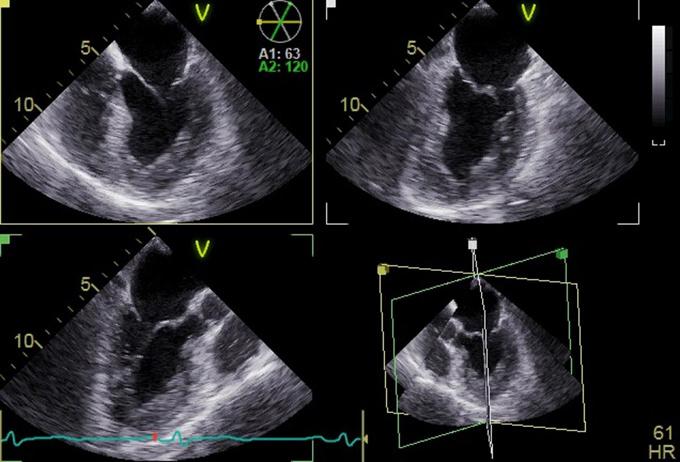 Fig. 37.2, Simultaneous display of multiple two-dimensional scan planes by multiplane imaging.