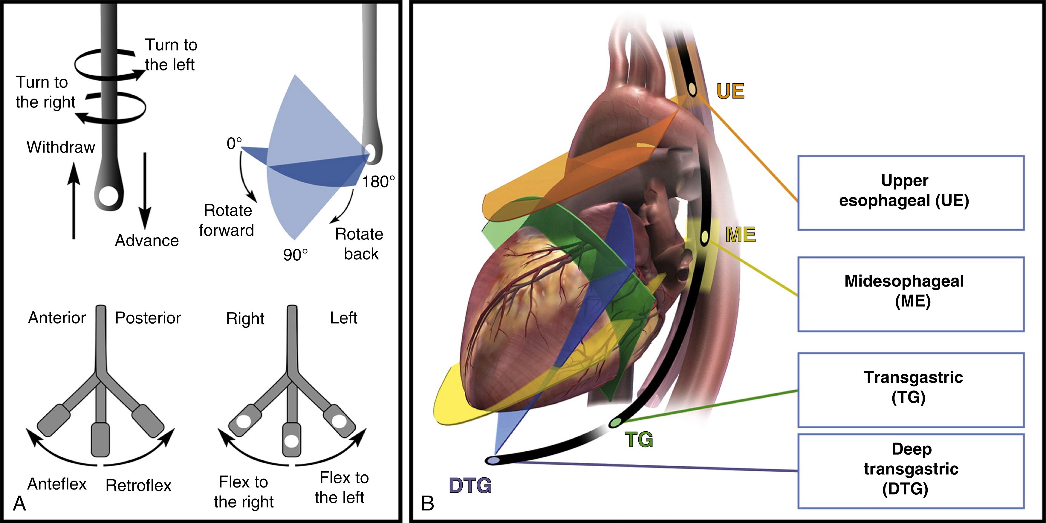 Fig. 37.5, Terminology used to describe manipulation of the transesophageal echocardiographic probe during image acquisition. (A) Terminology used for the manipulation of the transesophageal echocardiographic probe. (B) Four standard transducer positions within the esophagus and stomach and the associated imaging planes.