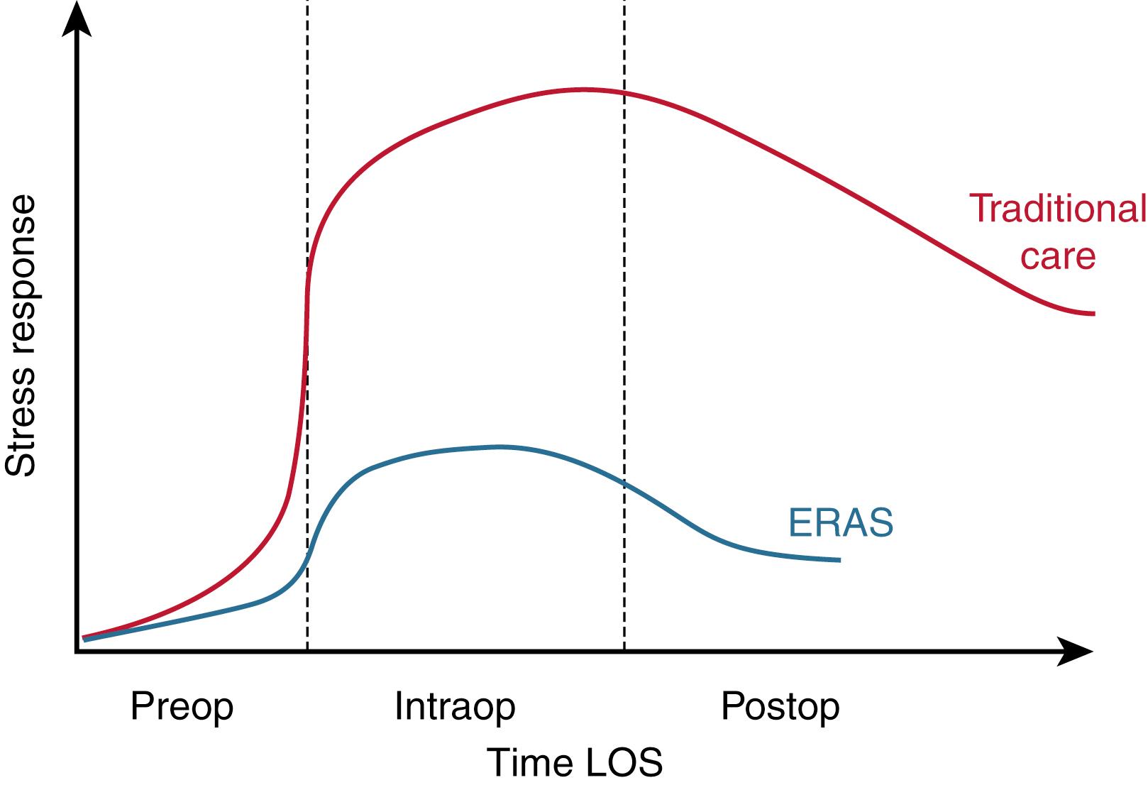 Fig. 79.1, Graph showing a patient’s journey through an enhanced recovery after surgery ( ERAS ) spinal surgery program, against the surgical stress response, compared with traditional care.