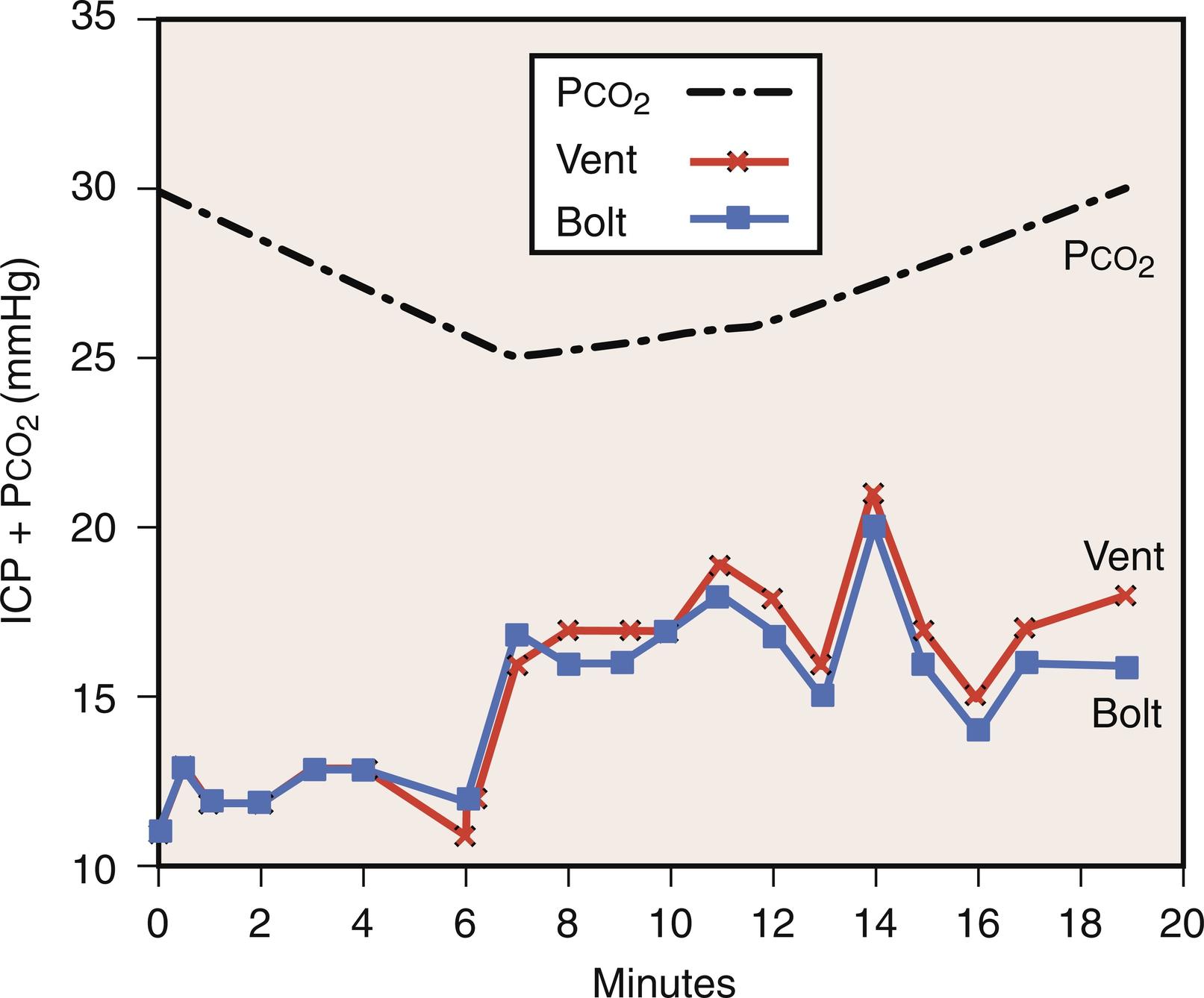 Fig. 24.12, Paradoxical rise in intracranial pressure (ICP) induced by mechanical hyperventilation, presumably a result of mechanical pressure effects predominating over hypocarbic cerebral vasoconstriction. It is likely that hyperventilation induced a decrease in blood pressure, which resulted in an opposing reflex increase in cerebral blood volume. “Bolt” refers to subarachnoid screw, “vent” to ventricular catheter.