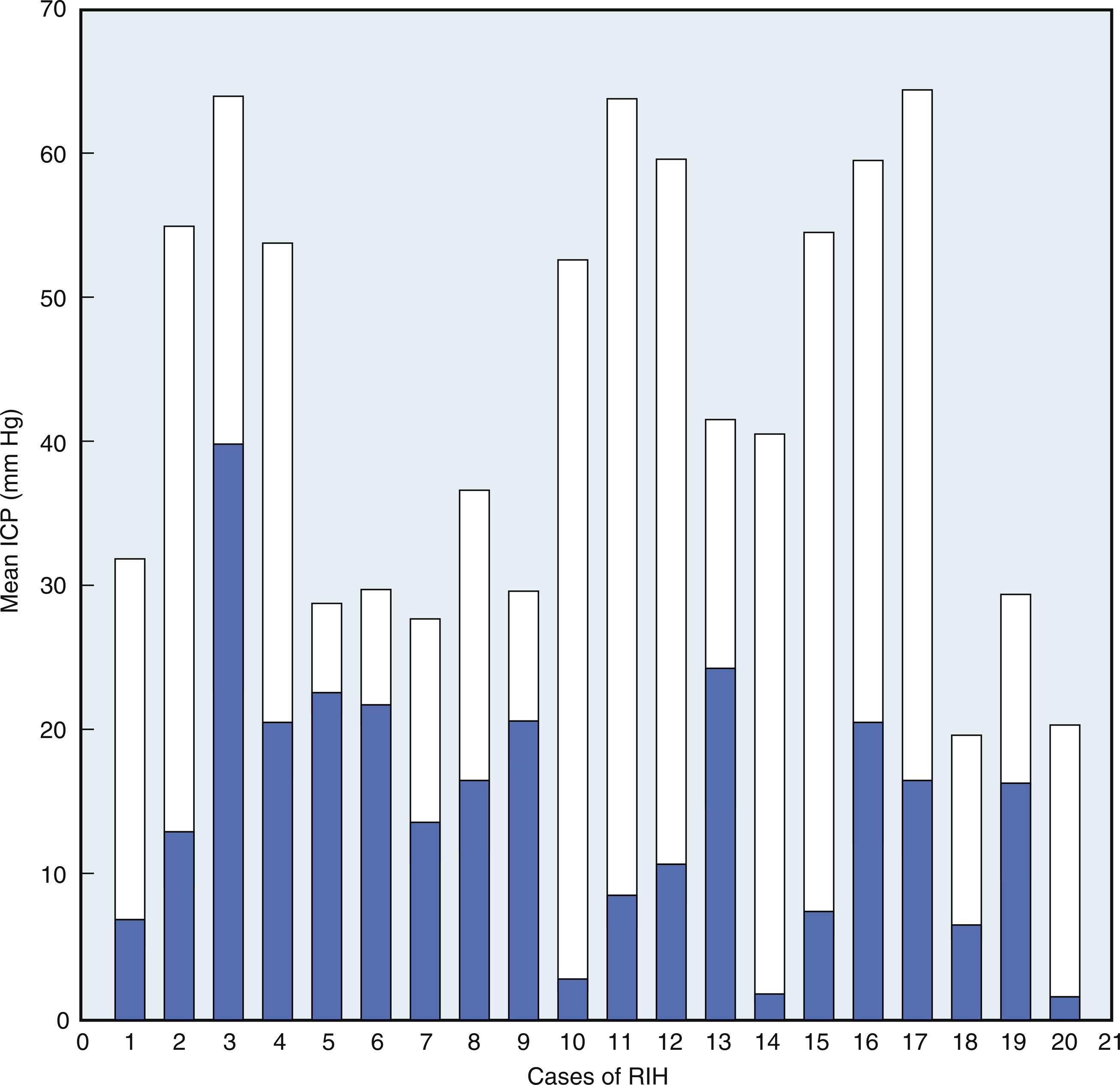 Fig. 24.13, This stacked-bar chart shows the mean pretreatment intracranial pressure (ICP) and the mean ICP 1 hour after treatment with 23.4% saline for every episode of refractory intracranial hypertension (RIH). Patient distribution is as follows: 1 , spontaneous basal ganglia hemorrhage; 2 , subarachnoid hemorrhage; 3 , subarachnoid hemorrhage; 4–6 , traumatic head injury; 7–8 , subarachnoid hemorrhage; ˆ, subarachnoid hemorrhage; 10–12 , subarachnoid hemorrhage; 13–20 , brain tumor.