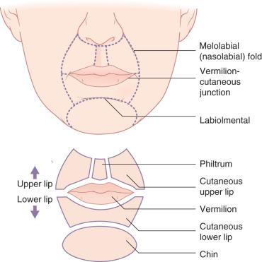 Fig. 16.1, Perioral cosmetic subunits.