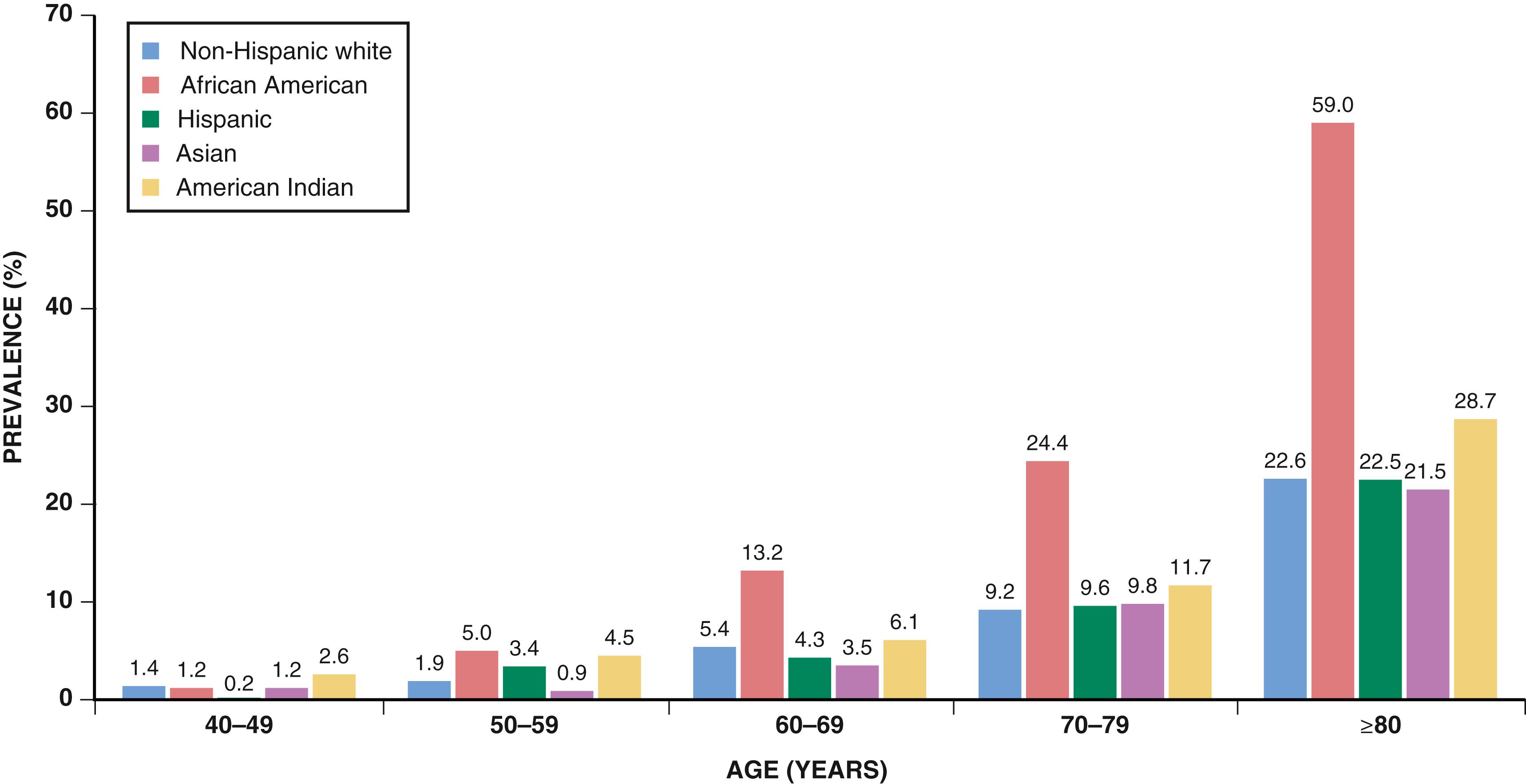 EFIGURE 43.1, Estimated prevalence of peripheral artery disease by age and ethnicity.