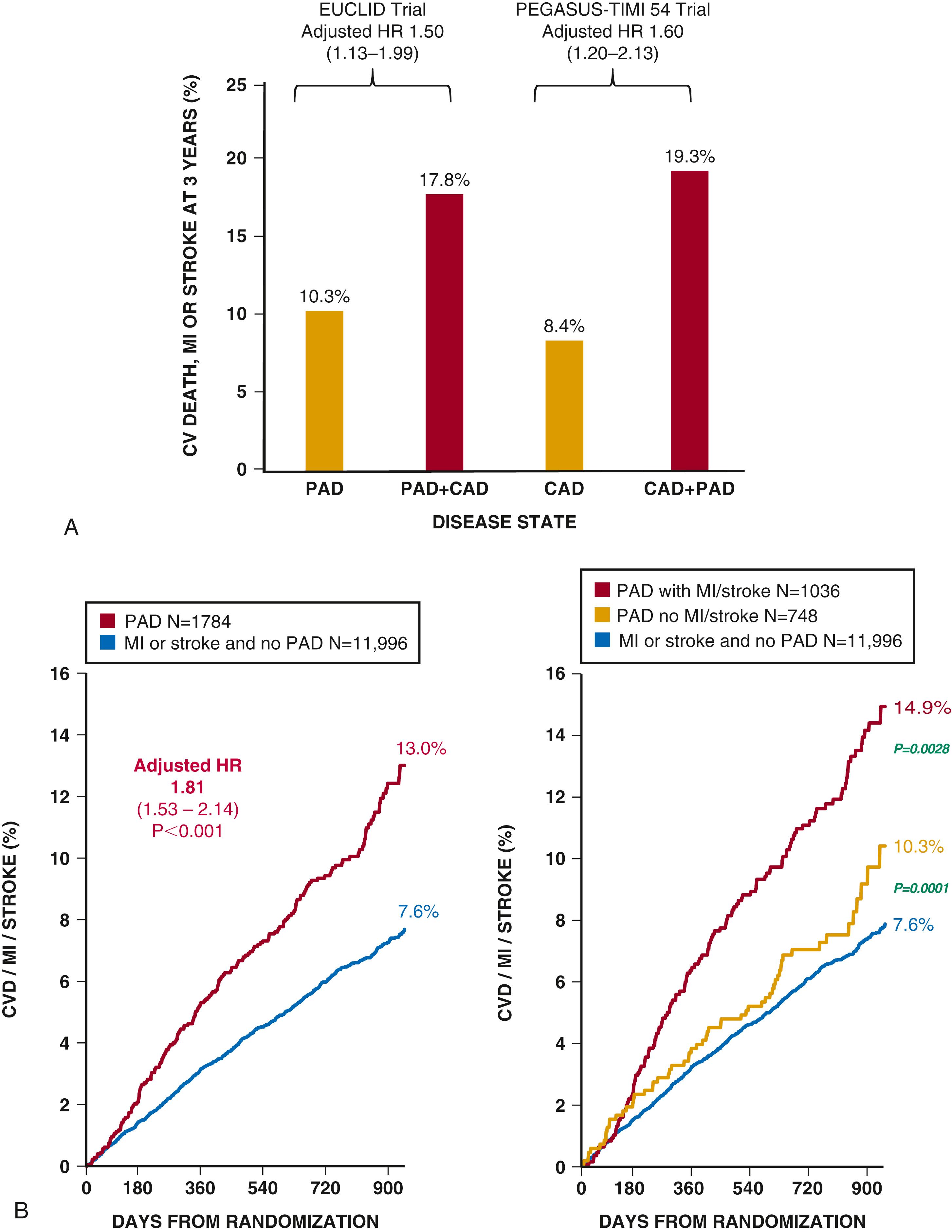 EFIGURE 43.5, A, Risk of major adverse cardiovascular events in patients with both peripheral artery disease (PAD) and coronary artery disease (CAD) (red bars) versus a single symptomatic territory (yellow bars). B, Risk of major adverse cardiovascular events in patients with peripheral artery disease (PAD) relative to those with prior myocardial infarction (MI) or stroke ( left graph ), with the PAD group stratified by polyvascular disease (red line) versus PAD only (yellow line).