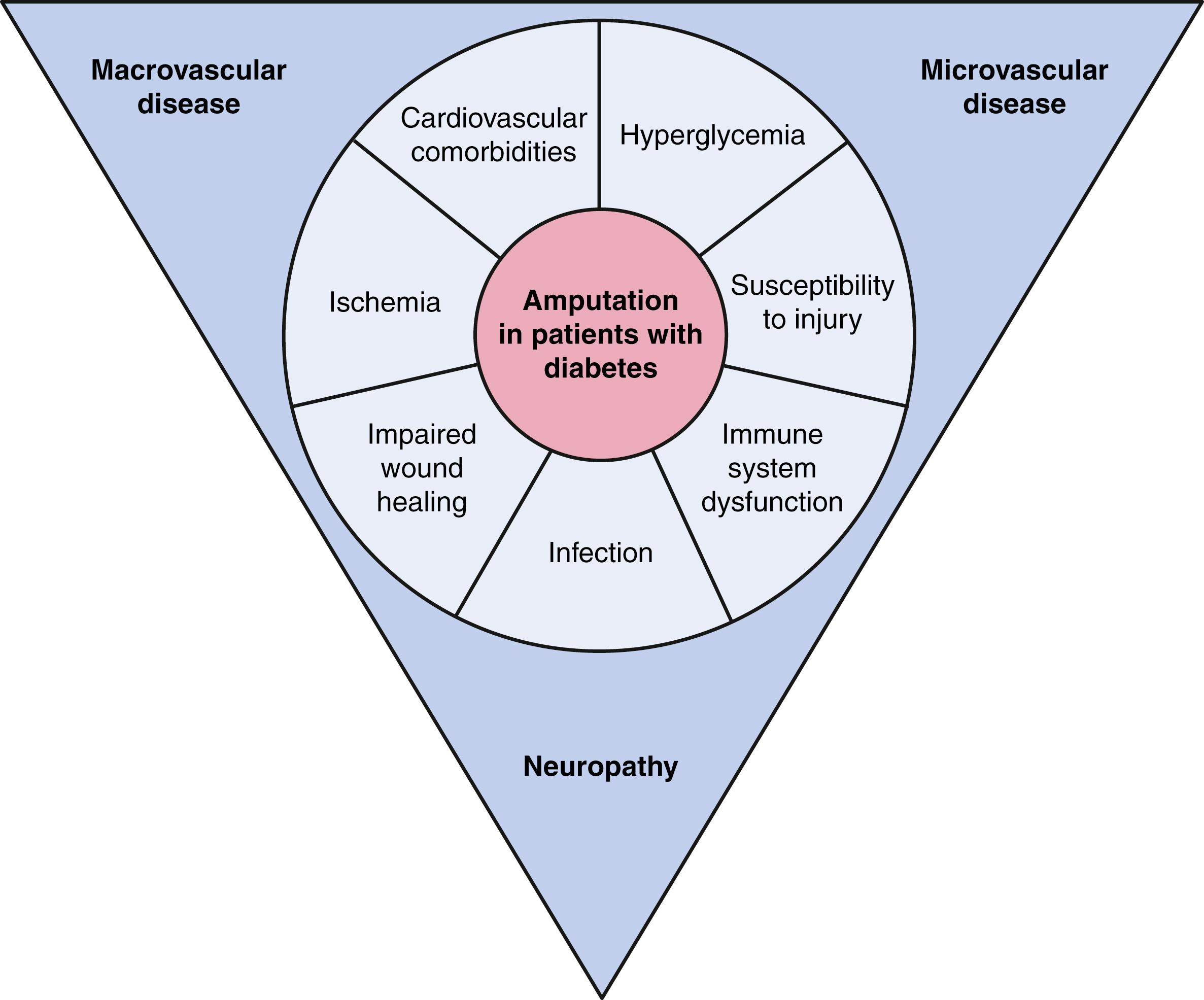 EFIGURE 43.4, Contributing factors in amputation in patients with peripheral artery disease and diabetes.