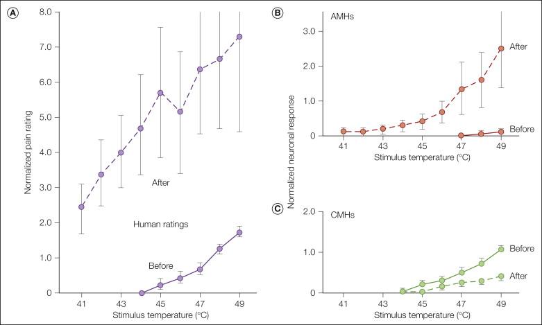 Figure 1-9, Hyperalgesia and nociceptor sensitization after a cutaneous burn injury.