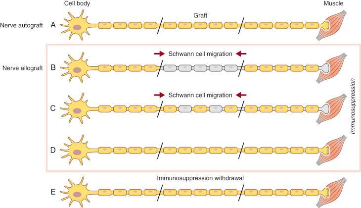 Figure 68.1, Schwann cell migration in a nerve allograft.
