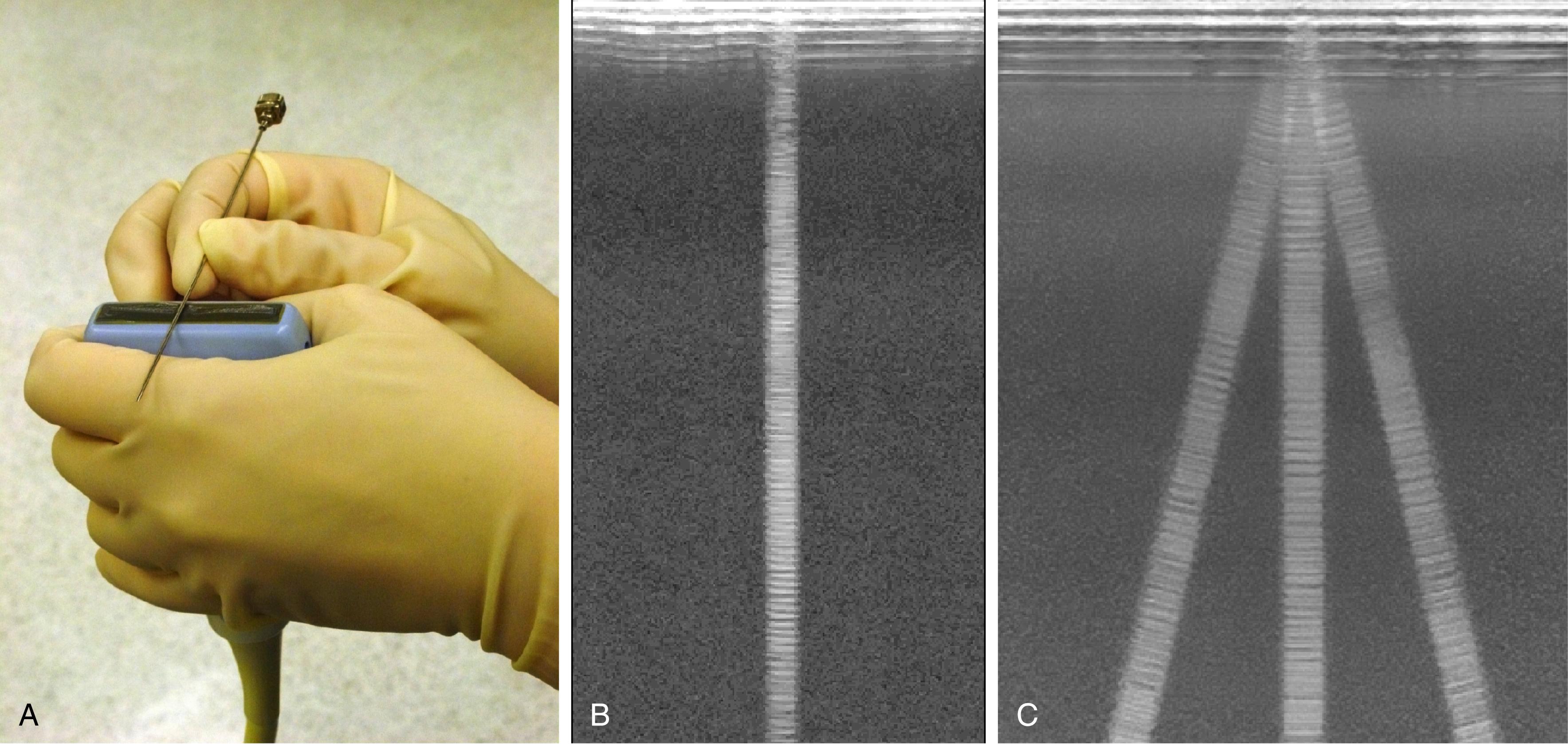 Fig. 46.8, Spatial compound imaging.