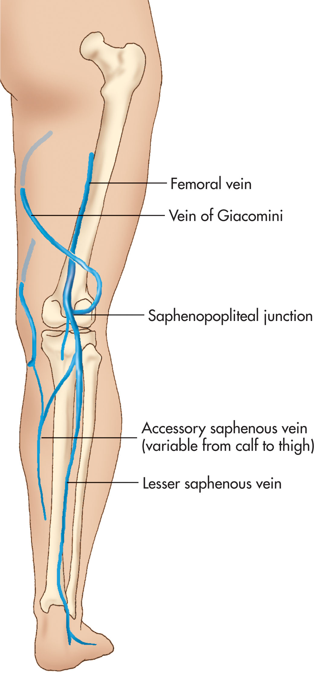 Fig. 40.3, The small saphenous vein, also referred to as the lesser saphenous vein, is a superficial vein that travels along the midline portion of the posterior calf. The small saphenous vein typically drains into the popliteal vein in the popliteal fossa.