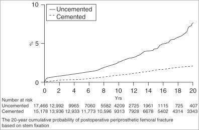 Fig. 107.1, Trend in periprosthetic femoral fractures over the last 20 years.