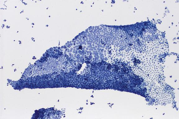 Fig. 5.1, Mesothelial Cells