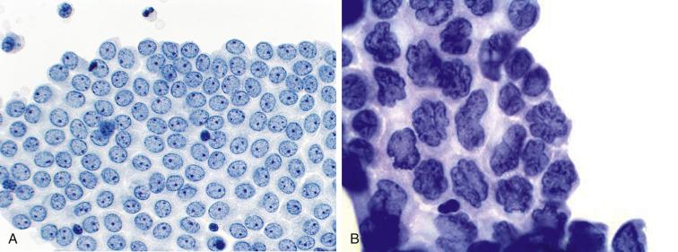 Fig. 5.3, Mesothelial Cells