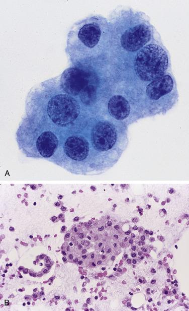 Fig. 5.5, Histiocytes