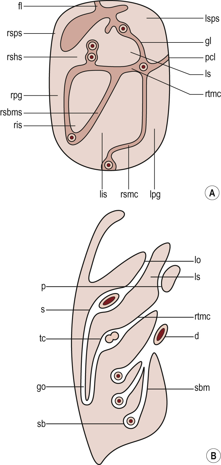(A) Coronal diagram showing division of the peritoneal cavity according to peritoneal attachments to the posterior abdominal wall. (B) Midsagittal diagram of the upper abdomen. Abbreviations: fl = falciform ligament; gl = gastrosplenic ligament; pcl = phrenicocolic ligament; ls = lesser sac; lsps = left subphrenic space; lpg = left paracolic gutter; lis = left infracolic space; rtmc = root of transverse mesocolon; rsbm = root of small bowel mesentery; ris = right infracolic space; rpg = right paracolic gutter; rshs = right subhepatic space; rsps = right subdiaphragmatic space; smb = small bowel mesentery; go = greater omentum; lo = lesser omentum; tc = transverse colon; sb = small bowel; s = stomach; p = pancreas; d = duodenum. **