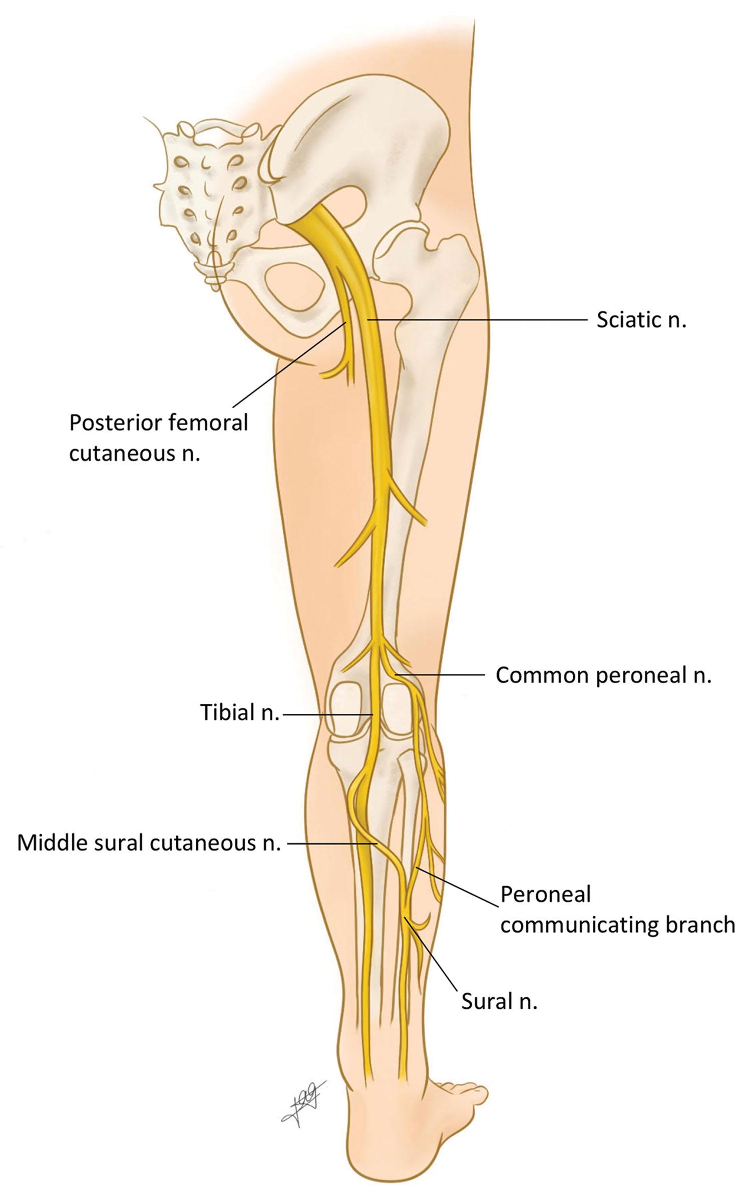 Figure 27.2, Posterior lower extremity anatomy. The peroneal nerve arises from the sciatic nerve just above the knee, two thirds of the way between the gluteal crease and the popliteal fossa. It then travels sideways along the outer part of the knee to the lateral border of the lower leg and foot.