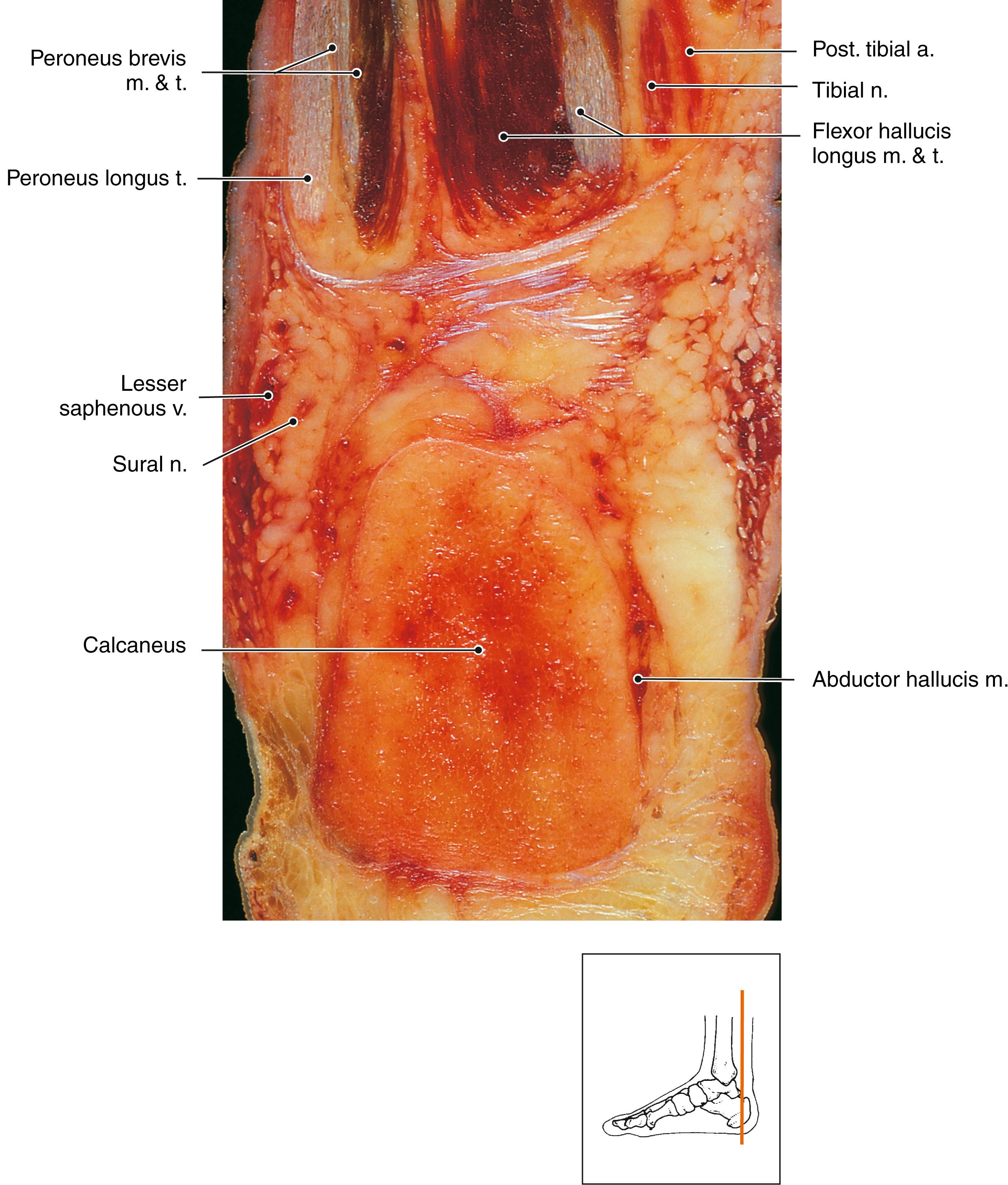 FIG. 188.6, Anatomy of the peroneus longus and brevis muscles and related structures.