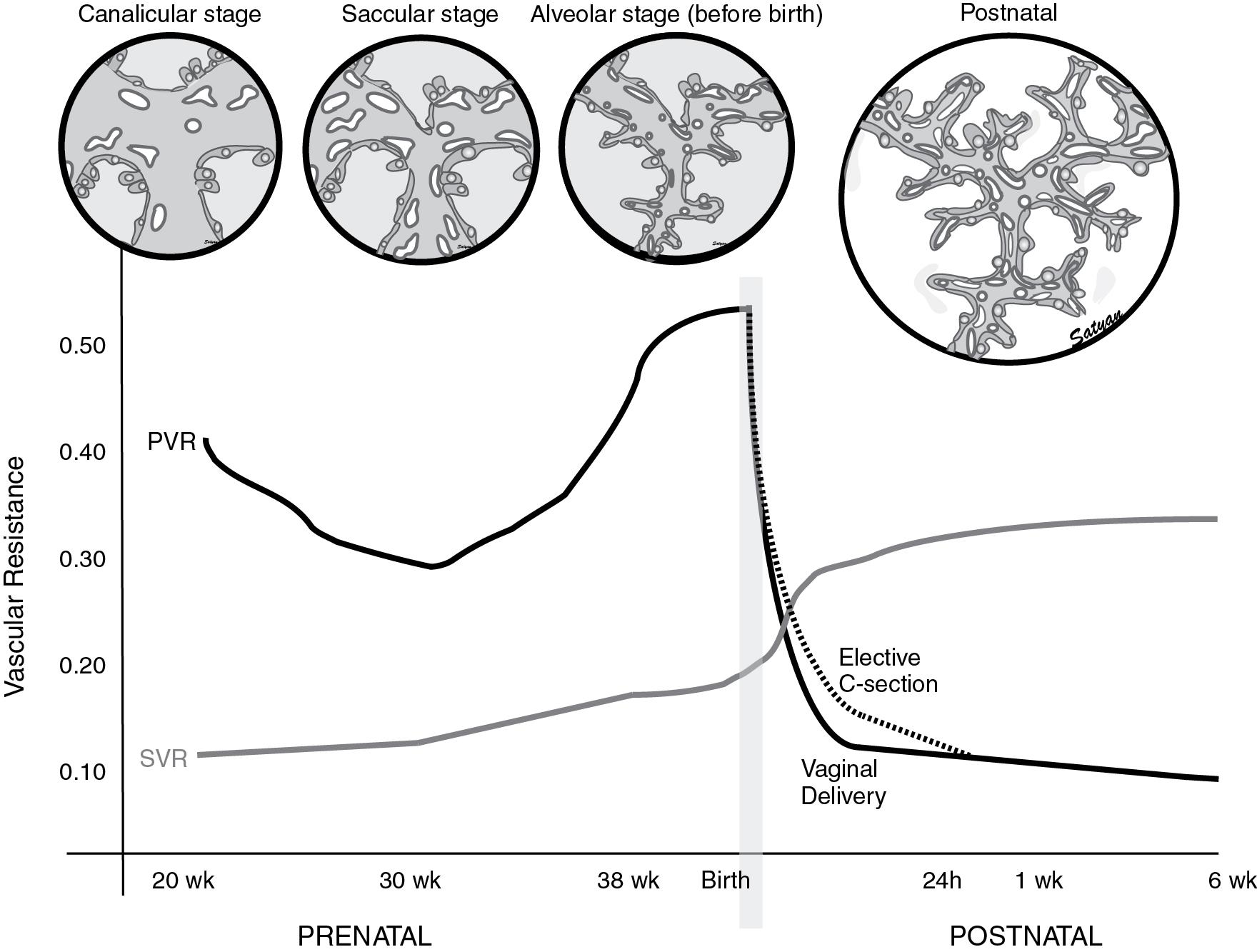 Fig. 17.3, Changes in pulmonary vascular resistance (PVR) and systemic vascular resistance (SVR) during the last half of gestation and postnatal period. During the canalicular phase of lung development, high PVR is caused by low density of vasculature. In the saccular stage, broad intersaccular septae contain the “double capillary network” and with increasing vascular density, PVR decreases. In the alveolar phase, despite the rapid increase in the number of small pulmonary arteries, high PVR is maintained by active vasoconstriction. After birth, lung liquid is absorbed and an air–liquid interphase is established with juxtaposition of capillaries and alveolar epithelium to promote effective gas exchange. Dashed line represents the delay in decrease of PVR observed following elective cesarean section. SVR markedly increases after clamping the umbilical cord and removal of the low-resistance placental circuit from the systemic circulation.