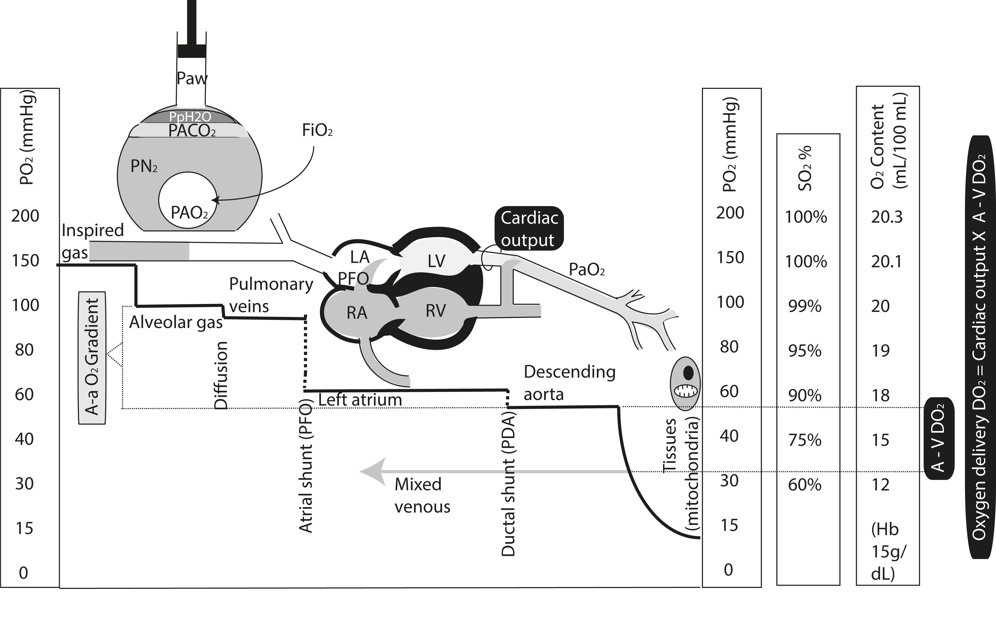 Fig. 17.8, Basics of gas exchange and transport. In this graph, the Y-axis represents P o 2 levels through the process of oxygen transport from inspired gas to the tissues and mitochondria. Approximate equivalent values for saturation (SO 2 in %) and oxygen content (in mL/dL assuming a hemoglobin level of 15 g/dL) are shown. The solid horizontal line shows approximate P o 2 values as oxygen moves from inspired gas to the alveolus. In the alveolus, oxygen is diluted by the presence of water vapor (ppH 2 O), nitrogen, and carbon dioxide. There is a slight decrease in P o 2 as oxygen diffuses from the alveolus to the pulmonary capillary. In the left atrium, right-to-left shunt across the patent foramen ovale (PFO) decreases P o 2 in neonates with PPHN. A similar right-to-left shunt from pulmonary artery to aorta through the patent ductus arteriosus (PDA) further decreases the P o 2 in the postductal aorta. As the blood traverses the capillary, P o 2 decreases as oxygen diffuses into the tissues. The P o 2 values are low within the cell and mitochondria. The difference between arterial and venous oxygen content is called AVDO 2 and is expressed in mL/dL. Multiplying AVDO 2 with cardiac output provides systemic oxygen delivery (DO 2 ).