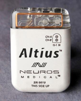 Figure 140.1, Altius High Frequency Nerve Block.