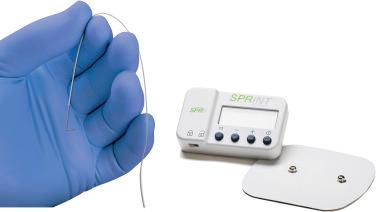 Figure 140.4, Altius High Frequency Nerve Block.