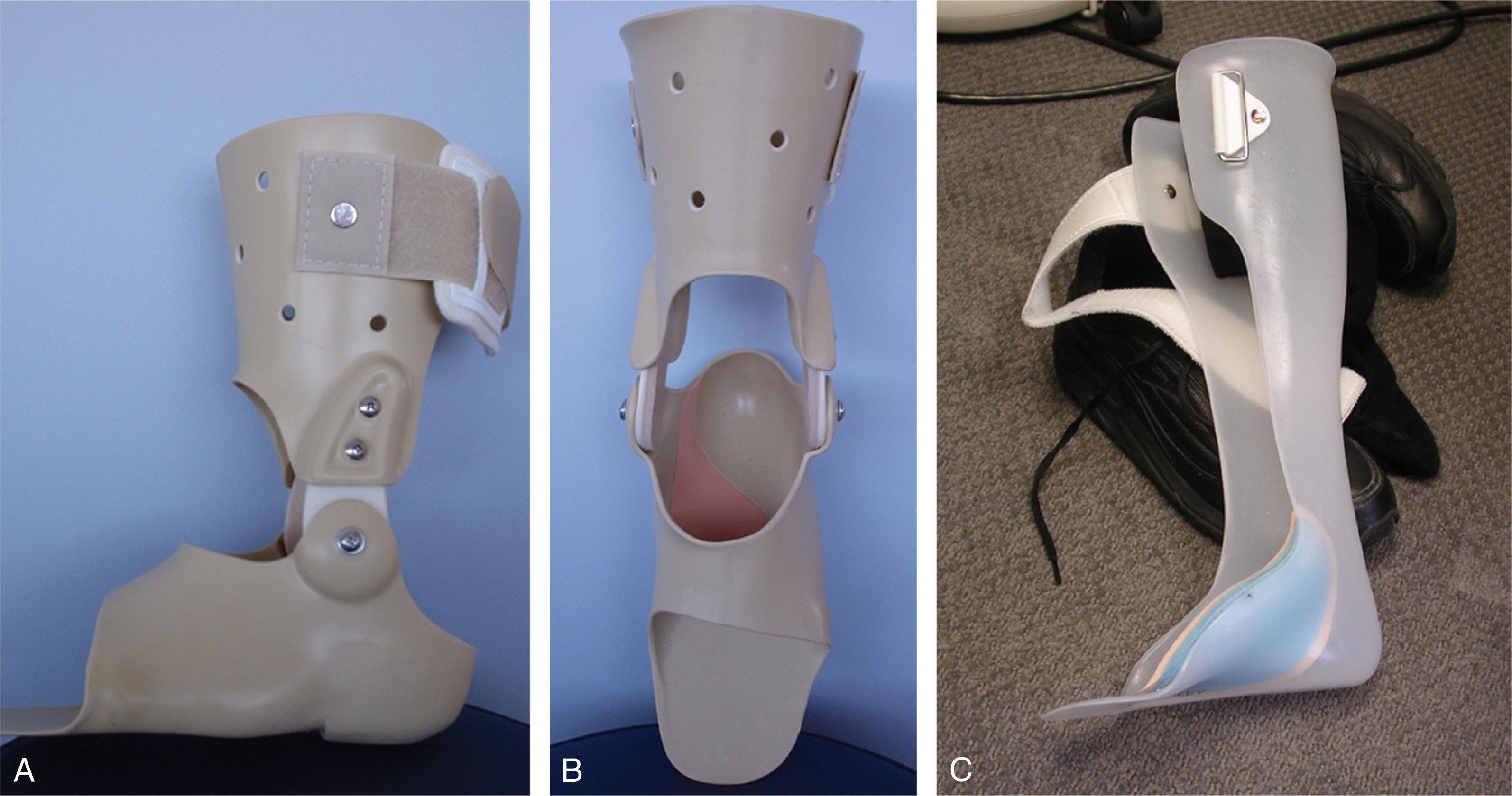 Fig. 29-19, An ankle–foot orthosis (AFO). A , This device can be used to stabilize both the ankle and the foot in patients with stage 3 disease. B , The foot piece can be molded to provide support similar to a University of California Biomechanics Laboratory (UCBL) orthosis. C , Alternatively, a solid ankle foot orthosis can be used in more advanced, stage 3 disease to provide absolute stabilization.