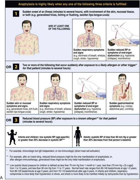 Figure 2-1, A, Clinical criteria for the diagnosis of anaphylaxis. B, Initial treatment of anaphylaxis.