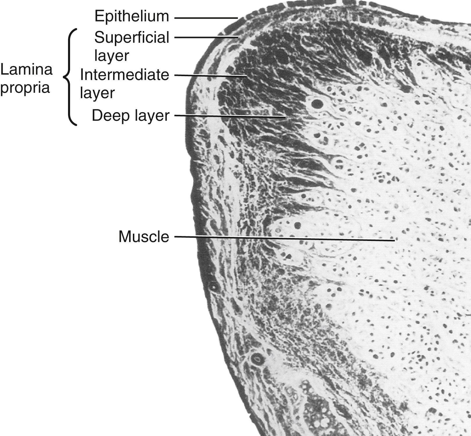 Fig. 2.1, Cross-sectional view of a vocal fold demonstrating layers of the vocal fold lamina propria.