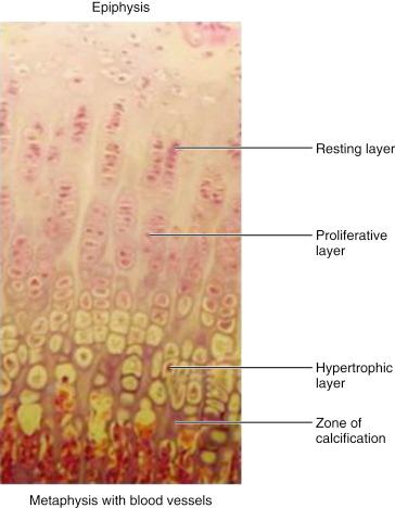 Fig. 2.2, Zones of the physis as seen on histologic examination.