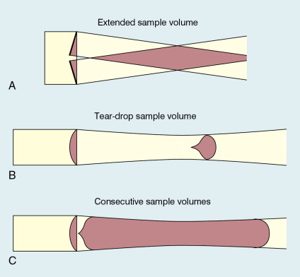 FIGURE 1-1, Sample volumes in Doppler techniques. (A) For dual crystal continuous wave Doppler unit. (B) For pulsed wave Doppler unit. (C) Neighbouring sample volumes along a beam for imaging Doppler units.