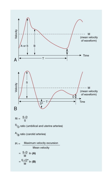 FIGURE 1-8, Waveform indices, normally calculated from a maximum velocity waveform, but the mean velocity waveform can also be used.