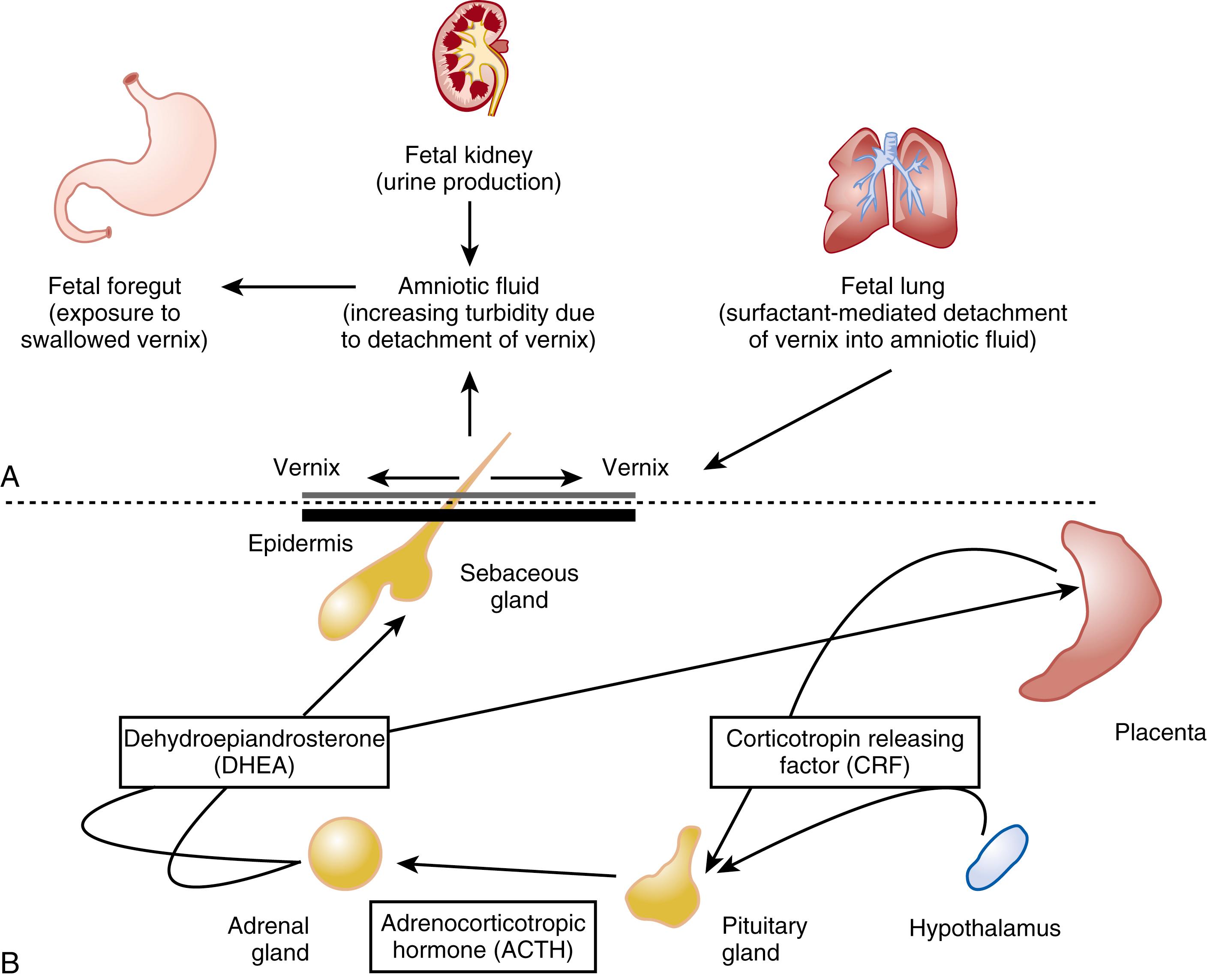 Fig. 44.4, (A) Proposed mechanism for pulmonary surfactant–mediated vernix detachment. The fetal kidney contributes significantly to amniotic fluid production. During the third trimester, vernix covers the developing epidermis, and the fetal lung produces and secretes increasing amounts of pulmonary surfactant into the amniotic fluid. Vernix on the skin surface builds up and detaches into the surrounding milieu, leading to amniotic fluid turbidity. 43 Vernix within the amniotic fluid is subsequently swallowed by the fetus, with potential effects on the fetal foregut and/or systemic absorption of vernix components. (B) Endocrine-based model for vernix production and epidermal barrier maturation. In this working model, corticotropin-releasing factors from either the placenta or the hypothalamus act to initiate adrenocorticotropic hormone release from the pituitary gland. Adrenocorticotropic hormone stimulation of the adrenal cortex promotes synthesis and release of androgenic steroids such as dehydroepiandrosterone (DHEA) , which are subsequently converted enzymatically within the sebaceous gland to active androgens. Production of superficial lipid film (sebum) in the immediate vicinity of the hair follicle modulates the transepidermal water gradient with putative effects to facilitate cornification of the underlying epidermis. 36 Desquamation of corneocytes into the overlying lipid matrix results in formation of vernix. The findings of Ito and colleagues 253 that human hair follicles synthesize cortisol and exhibit a functional equivalent of the hypothalamic-pituitary-adrenal axis raise interesting questions regarding local versus systemic control mechanisms in the schema.