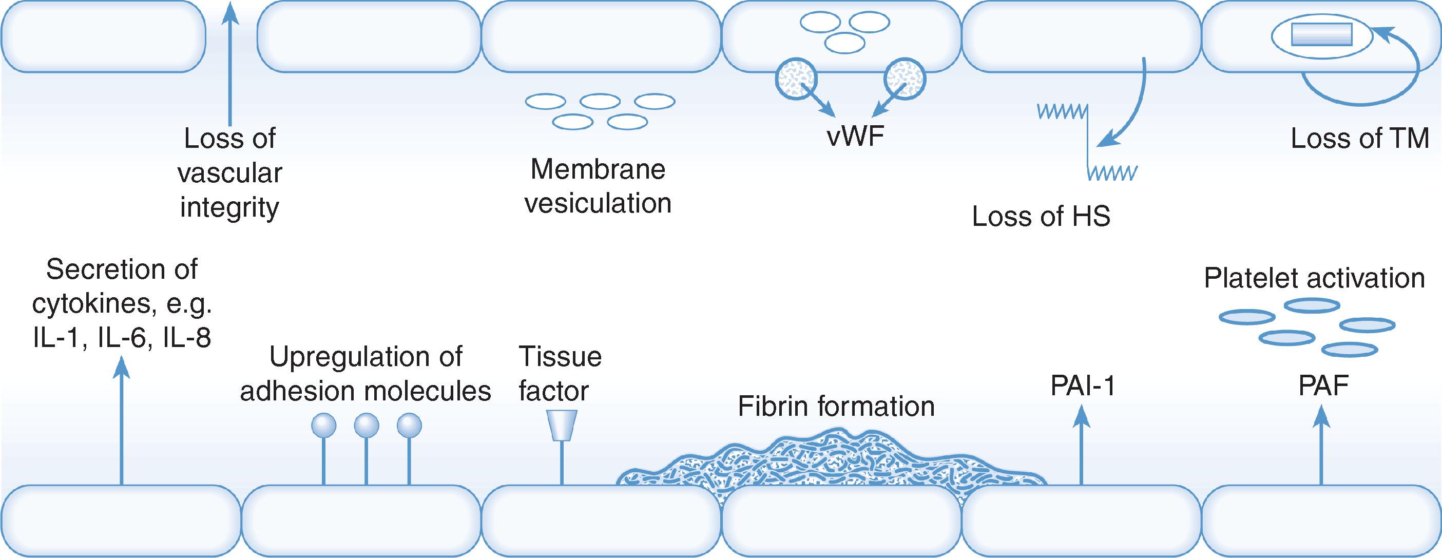 Fig. 10.14, The vascular endothelium in pre-eclampsia shows many of the characteristics of the inflammatory state of ‘endothelial cell activation’. Upon stimulation by inflammatory cytokines the endothelium undergoes a series of metabolic changes leading to loss of vascular integrity, prothrombotic changes ( HS , Loss of heparan sulphate; TM , loss of thrombomodulin; PAI-1 , release of plasminogen activator inhibitor; PAF , platelet activating factor; vWF , tissue factor and von Willebrand factor), secretion of cytokines and upregulation of leucocyte adhesion molecules. The cell adhesion molecules promote the adhesion and migration of leucocytes across the endothelium and so contribute to the inflammatory process.