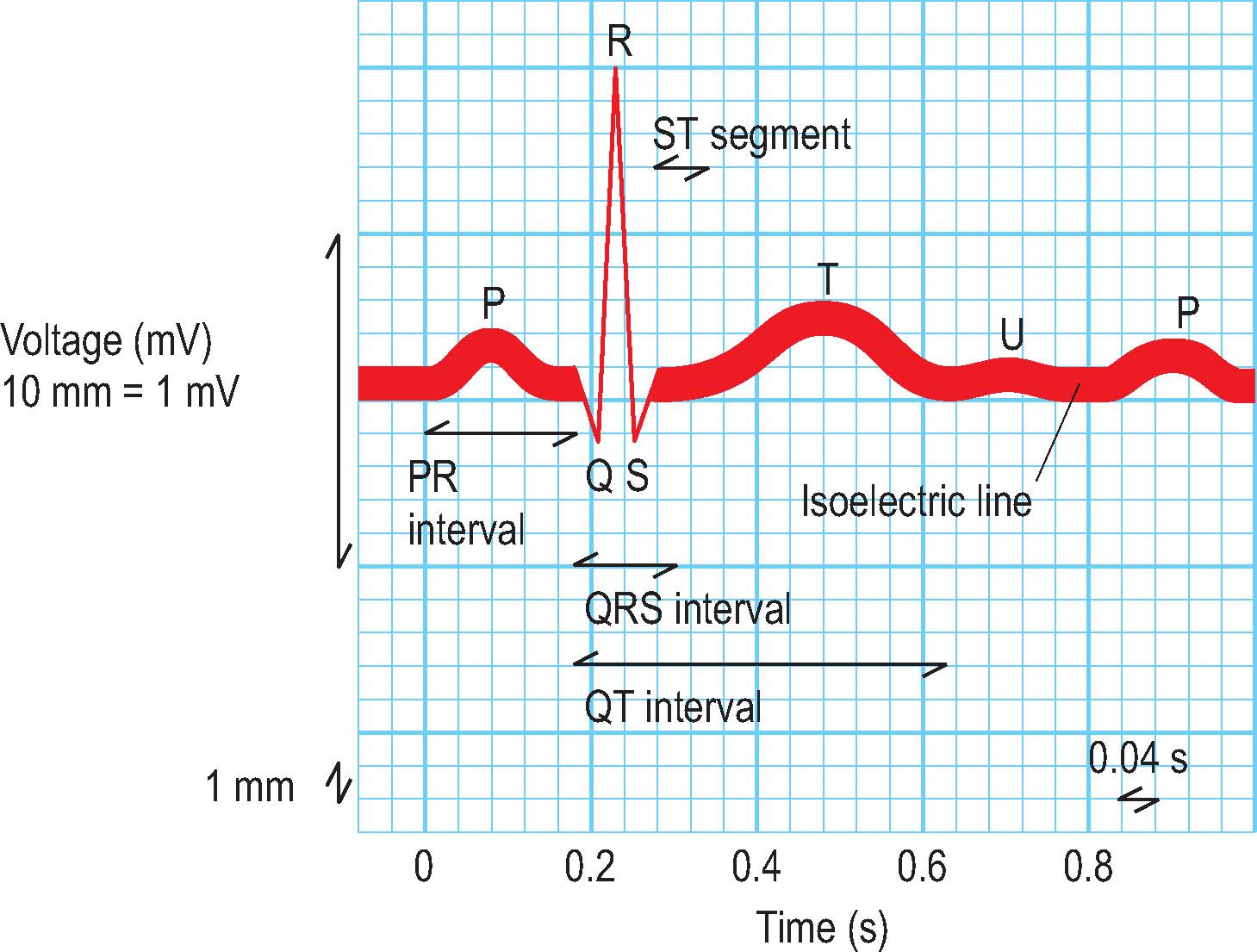 Fig. 10.6, The normal electrocardiogram.