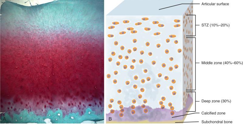 Fig. 1.4, Normal articular cartilage structure. Histologic (A) and schematic (B) views of a section of normal articular cartilage. The tissue consists of four zones: the superficial tangential zone (STZ), the middle zone, the deep zone, and the calcified zone. Notice the differences in cell alignment among zones. The cells of the superficial zone have an ellipsoidal shape and lie with their long axes parallel to the articular surface. The cells of the other zones have a more spheroidal shape. In the deep zone, they tend to align themselves in columns perpendicular to the joint surface.