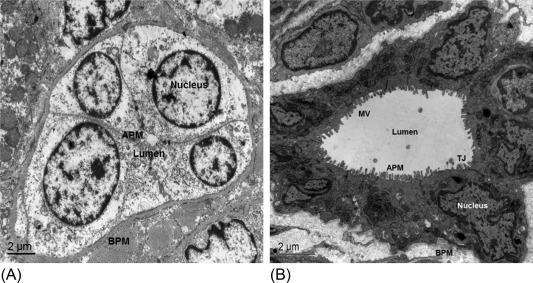 Fig. 44.3, Cholangiocytes of small human and large rat intrahepatic bile ducts. A small bile duct lined by 4 cholangiocytes in a healthy human liver (A), and a large bile duct lined by 11 cholangiocytes in the rat liver (B). Cholangiocytes are polarized cells with well-defined apical (APM) and basolateral (BPM) plasma membranes. They are demarcated by tight junctions (TJ) located between adjacent cells in proximity to the apical membrane. The cholangiocyte nucleus is often notched. Numerous microvilli (MV) on the apical membrane significantly increase the cholangiocyte apical surface.