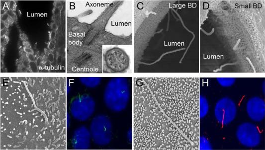 Fig. 44.4, Cholangiocyte primary cilia. Light (A) and transmission electron microscopy (B) micrographs of primary cilia extending from the cholangiocyte apical plasma membrane into the ductal lumen. The inset in (B) shows a 9 + 0 pattern of the ciliary axoneme. In (A), cilia were stained with an antibody to the ciliary marker, acetylated α-tubulin. Scanning electron microscopy images of primary cilia in large (C) and small (D) bile ducts in the rat liver. In the large bile ducts (C), cilia are approximately two times longer than that in the small bile ducts (D). Scanning electron microscopy (E,G) and immunofluorescence confocal microscopy (F,H) images of primary cilia in normal mouse (E,F) and rat (G,H) cholangiocyte cell lines. In (F) and (H), cilia were stained with acetylated α-tubulin ( green and red , respectively), nuclei were stained with DAPI ( blue ).