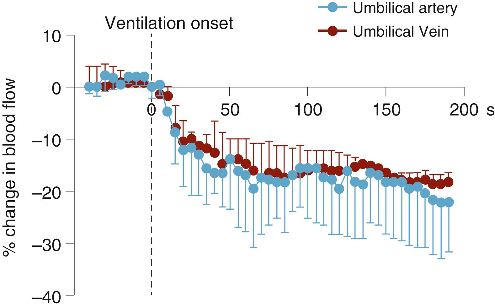Fig. 150.8, Changes in umbilical artery and venous blood flow in response to ventilation onset and the decrease in pulmonary vascular resistance (PVR) following delivery, but before umbilical cord clamping. The decrease in PVR redirects right ventricular output through the lungs and initiates left-to-right shunting across the ductus arteriosus. As a result, the increase in PBF “steals” blood flow from the placenta and the lung acts as a competitive (to the placenta) low-resistance pathway for blood flow derived from both right and left ventricles. PBF , Pulmonary blood flow.