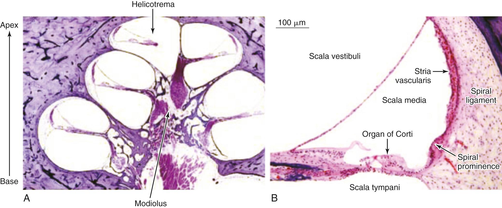 Fig. 128.3, (A) Histologic section showing a normal human cochlea (hematoxylin and eosin stain). The cochlea is shaped like a snail and has a spiral configuration with turns. The center portion of the spiral is called the modiolus. The portion of the cochlea that is closest to the oval window is the base, and the portion farthest away from the oval window is the apex. (B) Higher magnification of this histologic section shows the organ of Corti. The cochlea is a fluid-filled space with three compartments: the scala tympani, scala media, and scala vestibuli. The scala tympani and scala media are separated by the basilar membrane; the scala media and scala vestibuli are separated by the Reissner membrane. The scala tympani and scala vestibuli join together at the apex of the cochlea to form the helicotrema. The scala media contains the organ of Corti, which rests on the basilar membrane. The organ of Corti and the basilar membrane together are sometimes referred to as the cochlear partition. The stria vascularis plays an important role in maintaining the electrochemical environment of the cochlea.