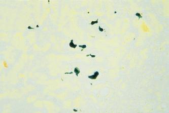 Fig. 14.4, Bile in a section of liver stained with Hall’s method for bilirubin. Bilirubin is stained emerald green.