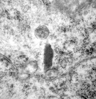 Fig. 14.5, Transmission electron micrograph of a stage 3 melanosome, demonstrating the characteristic internal lamellae structure.