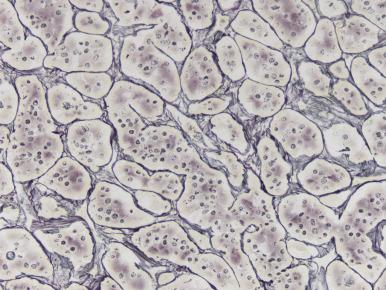 Figure 44.9, Reticulin stain better allows for appreciation of the normal acinar pattern of the anterior pituitary gland than does H&E staining.