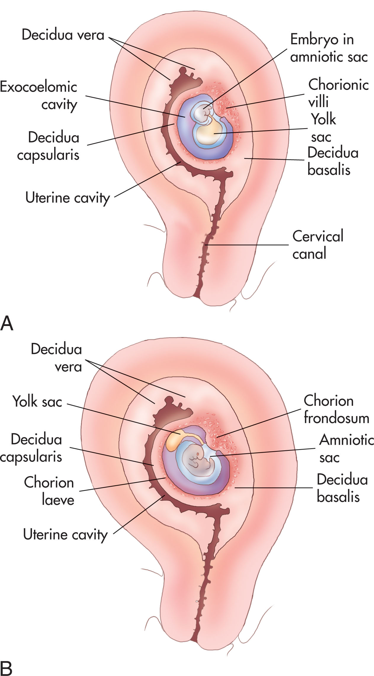 Fig. 56.1, (A) The placenta has two components: the fetal portion, developed from the chorion frondosum (chorionic plate), and a maternal portion, the decidua basalis, formed by the endometrial surface. (B) The chorionic villi gradually atrophy and disappear (chorion laeve). The chorionic villi in the decidua basalis increase rapidly in size and complexity.