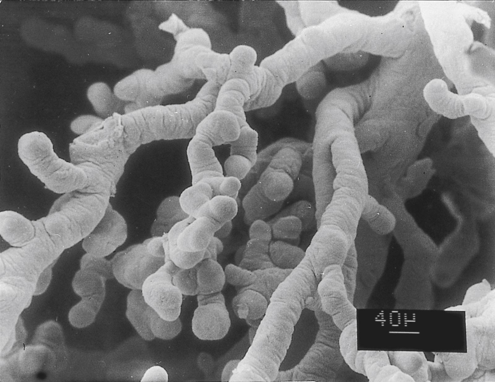 Fig. 7.13, Scanning electron micrograph of long, intermediate, knoblike terminal (floating) villi from a normal placenta near the termination of pregnancy.